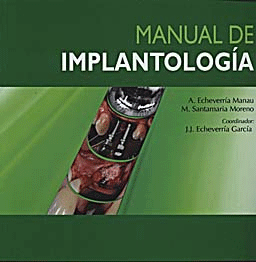 Manual de implantología de Echeverría Manau; Santamaria Moreno, 9788484738183, MEDICINA, odontología | implantología, Ergon, Español