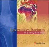Las grandes fracturas de la tierra y de los huesos, , geología
